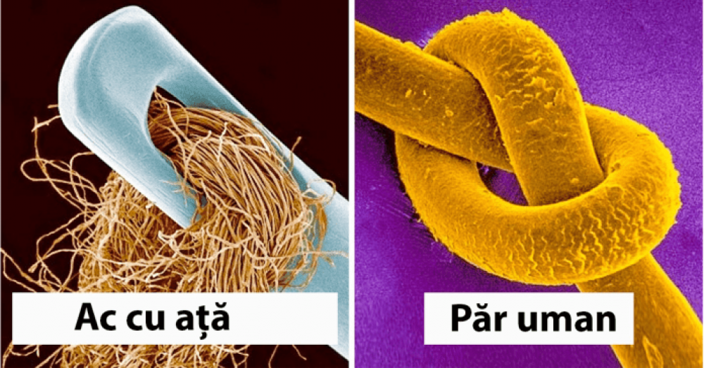 (FOTO) 20 de lucruri obișnuite care par atât de ciudate sub microscop încât zici că aparțin unui univers paralel